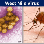 West Nile Virus | Norovirus