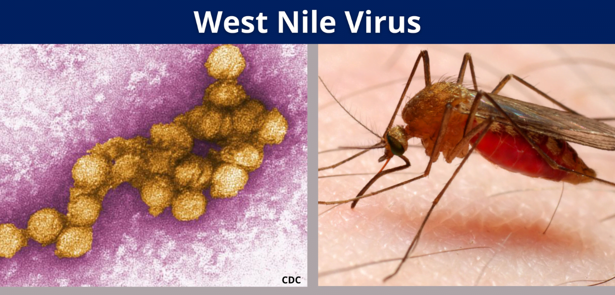 West Nile Virus | Norovirus